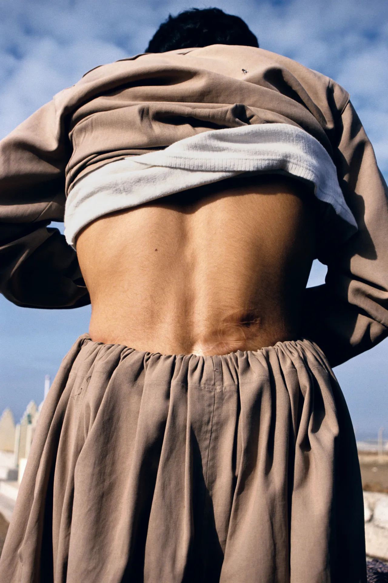 Taymour Abdullah, 15, the only survivor of village execution, shows his bullet wound, Arbil, Northern Iraq, December, 1991 © Susan Meiselas