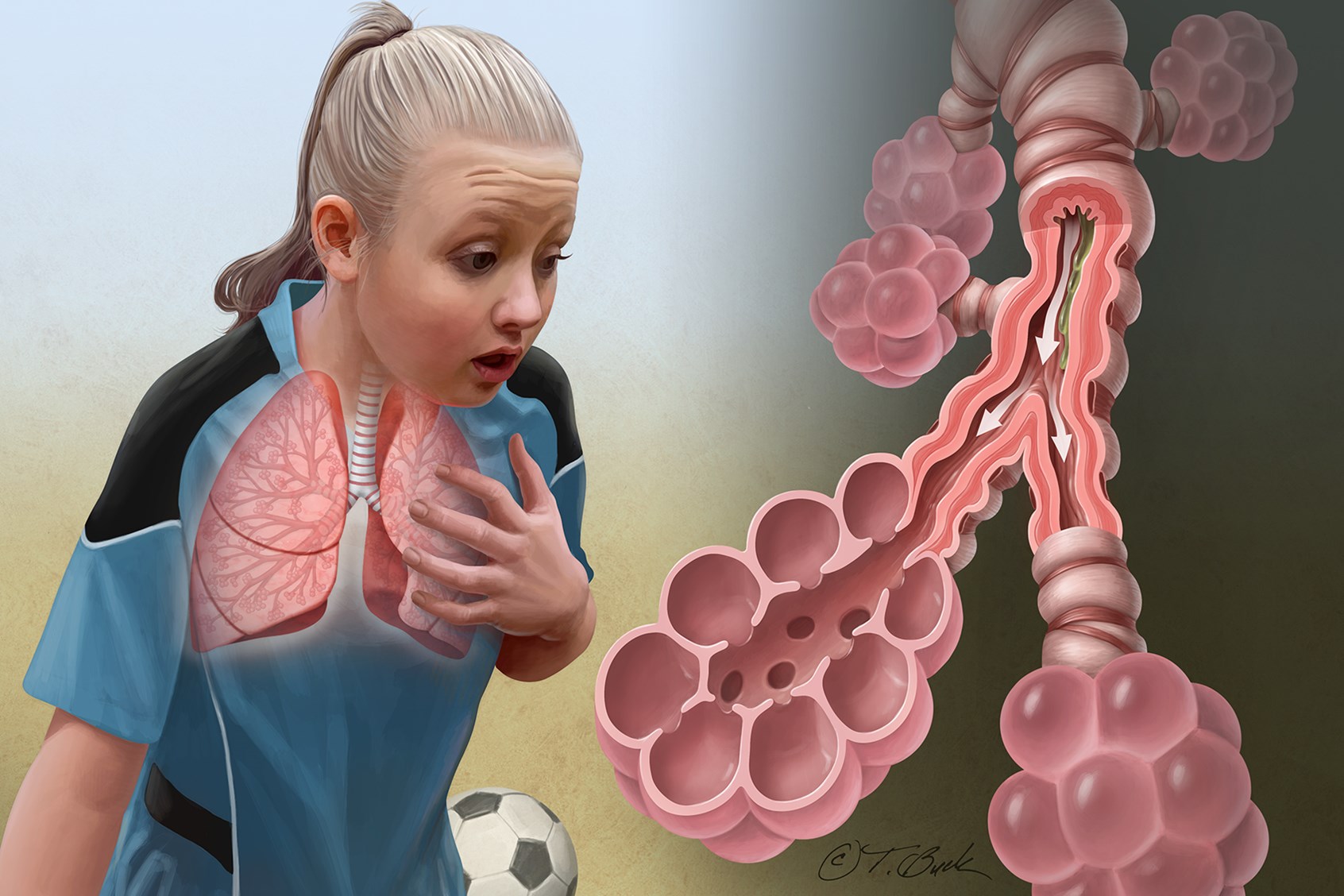 Asthma © Todd Buck