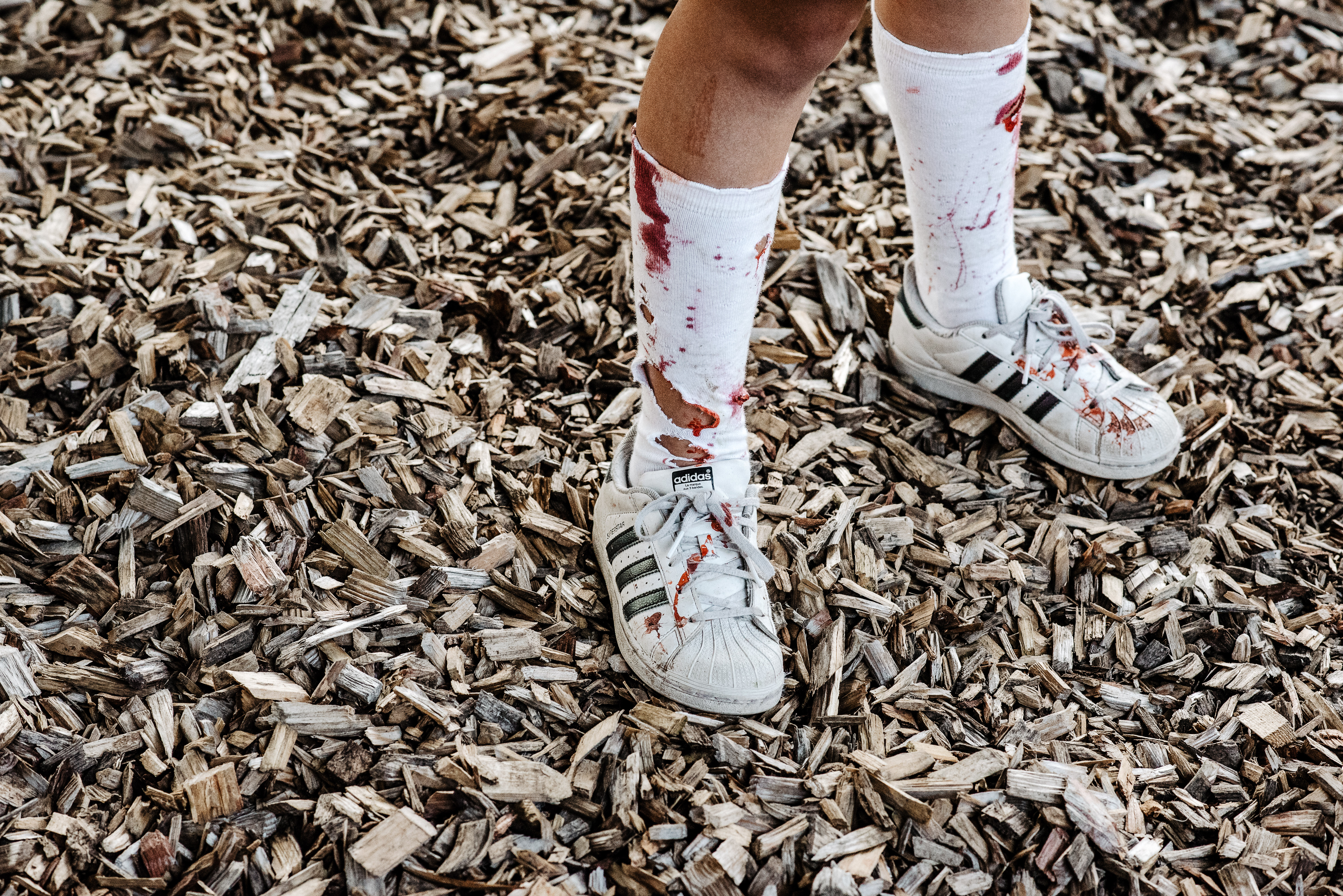 Zombie Legs © Zomblogalypse . Photography by Esme Mai