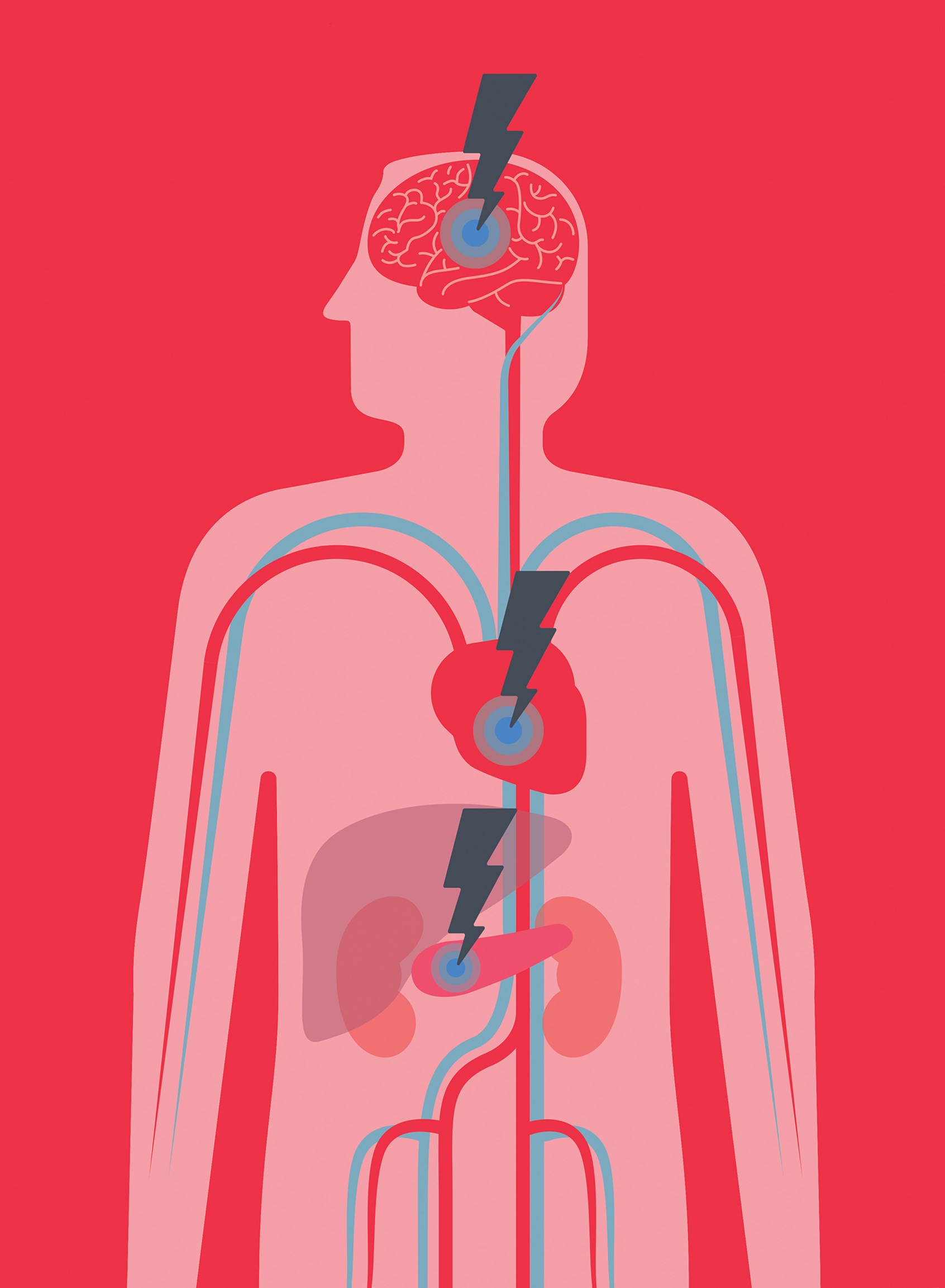 An illustration for the British Heart Foundation, showing some of the effects of Diabetes on the body © Andrew Baker